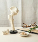 osteoporosi