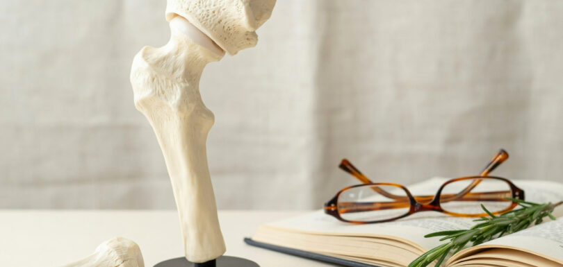 osteoporosi